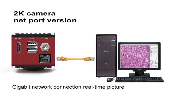 กล้องดิจิตอลไมโครสโคป HDMI 60FPS พร้อมอินเทอร์เฟซเครือข่ายกิกะบิต